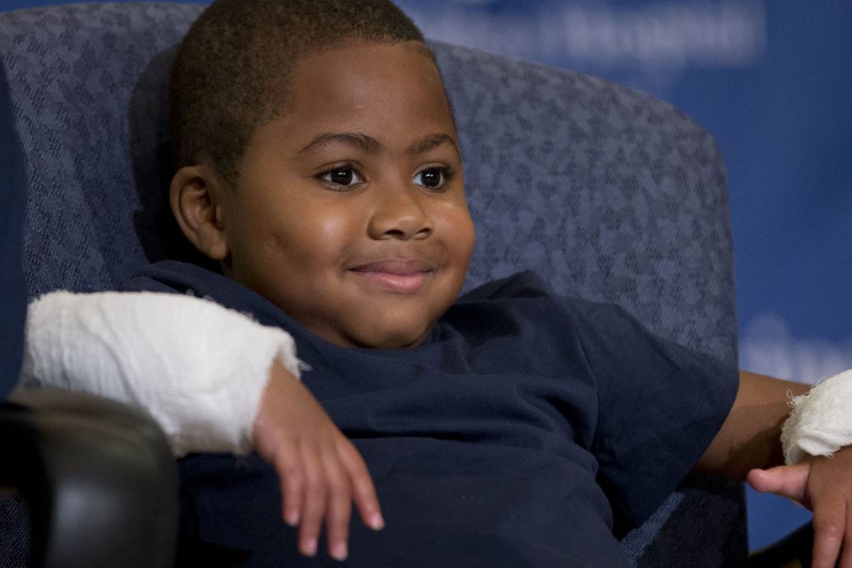 Baltimore Boy Becomes Youngest Recipient Of Double-Hand Transplant