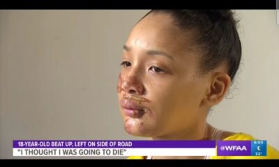 Texas teen beaten by friends