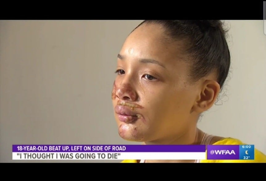 Texas teen beaten by friends