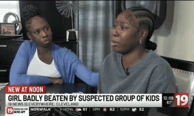 Arrest 5-year-old Cleveland girl assault