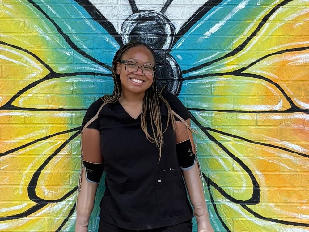 Celeste Bradley sepsis survivor Madison Alabama woman sepsis Alabama quadruple amputee GoFundMe