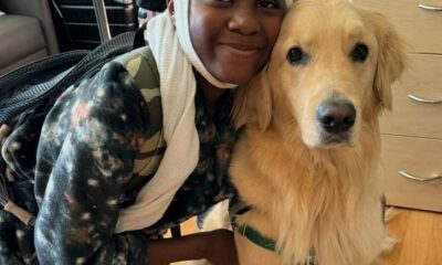 Daryien brain surgery frontal lobe epilepsy