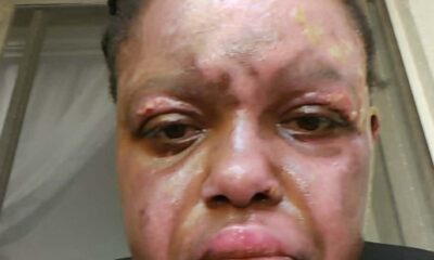 Rachel Price South Florida woman set on fire