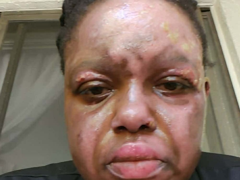 Rachel Price South Florida woman set on fire